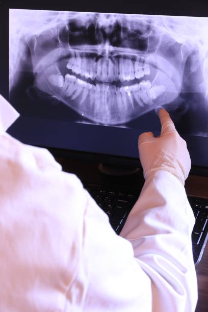 Best Emergency Dental Care for Broken or Chipped Teeth in Commercial Point, OH
